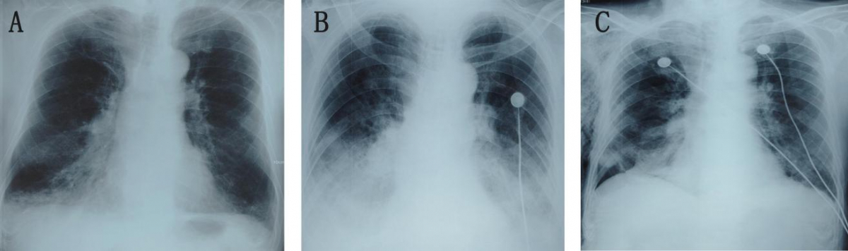 image-20260424124129-6